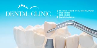 Implantul dentar, la Dental Clinic