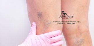 Tratamentul venelor superficiale cu laser Eufoton la clinica Absolute Aestetics
