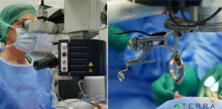 Premieră: Operații de cataractă, la Terra Clinique Galați